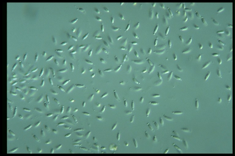 protist image