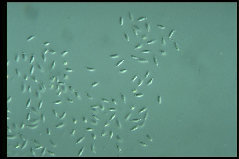 protist image