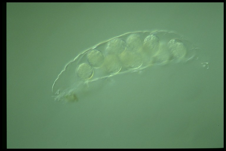 protist image