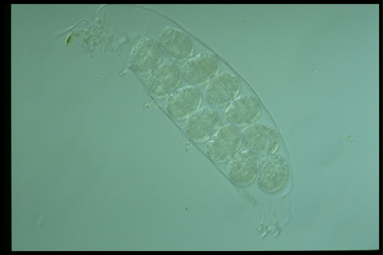 protist image