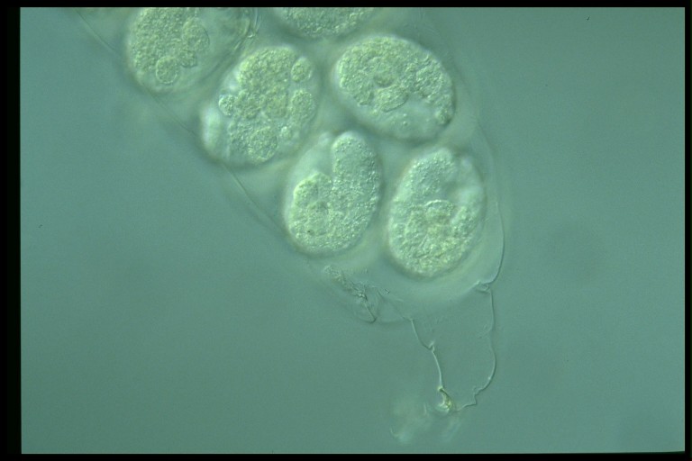 protist image