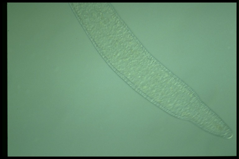 protist image