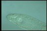 Stenostomum