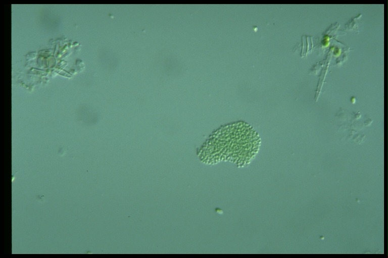 protist image