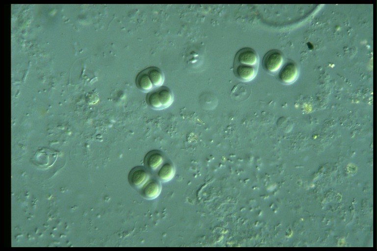 protist image