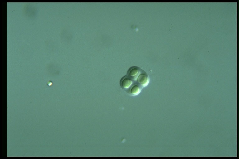 protist image