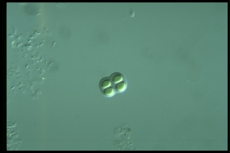 protist image