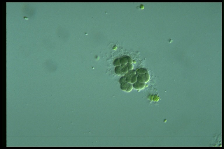 protist image