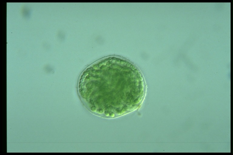 protist image