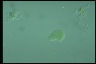 Microcystis