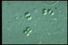 Chroococcus turgidus