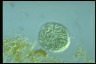 Anabaena