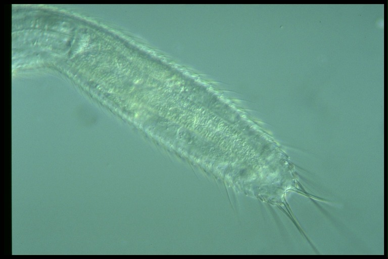 protist image