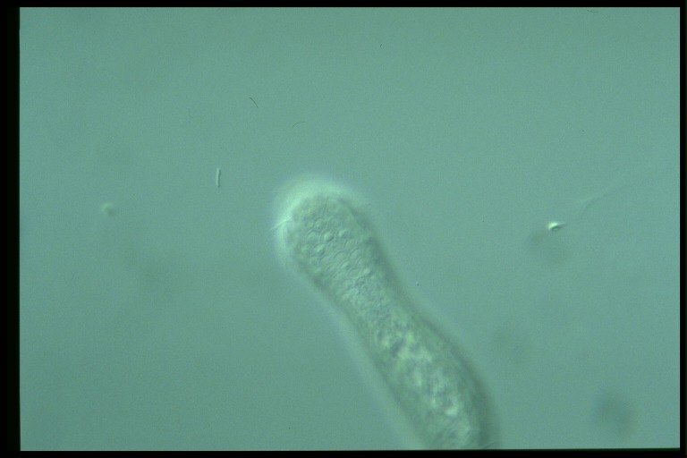 protist image