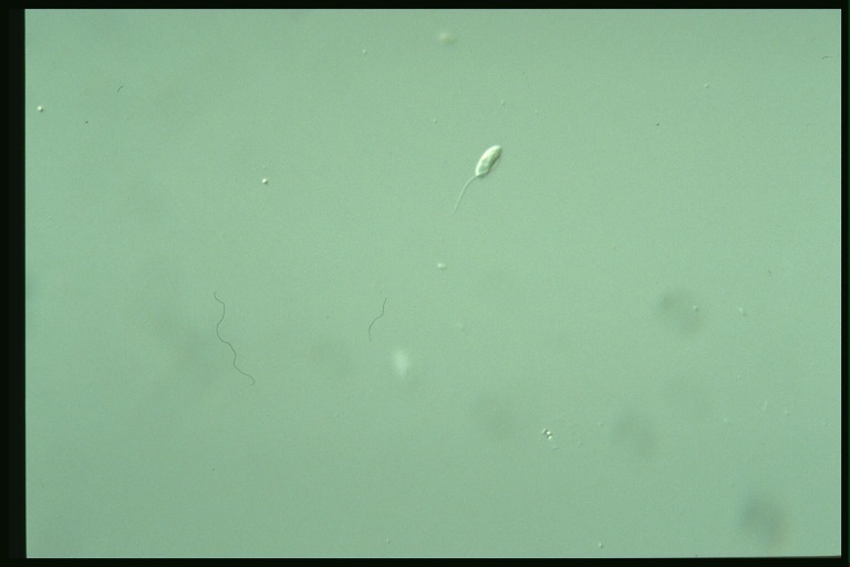 protist image