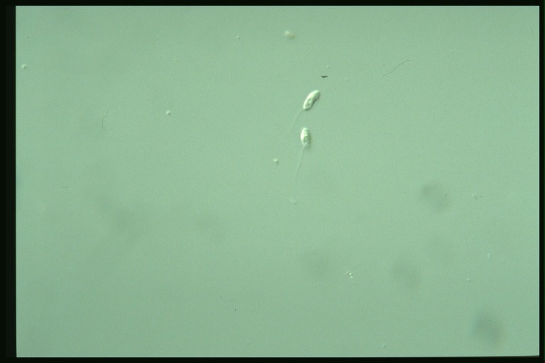 protist image