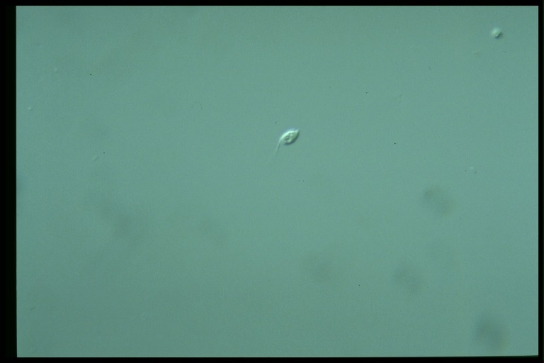 protist image