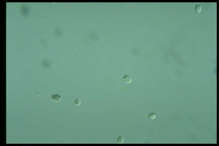 protist image