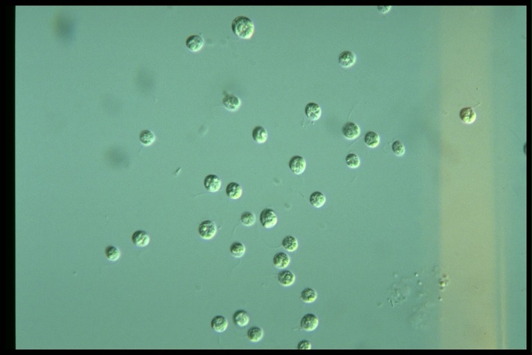 protist image