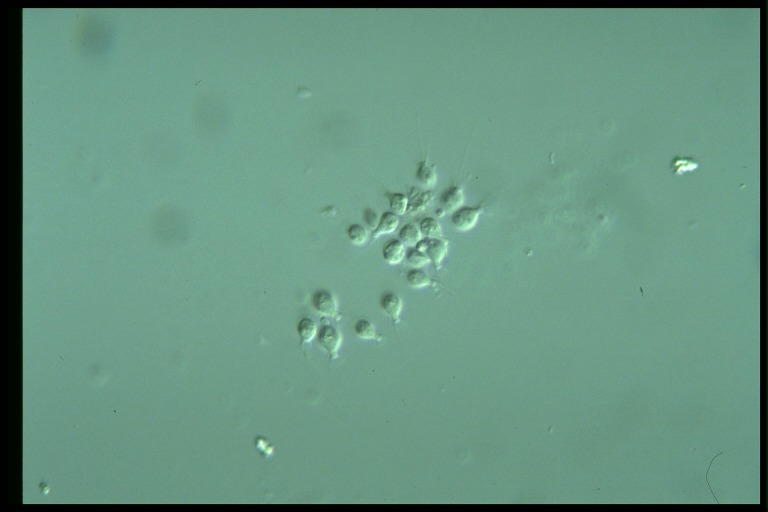 protist image