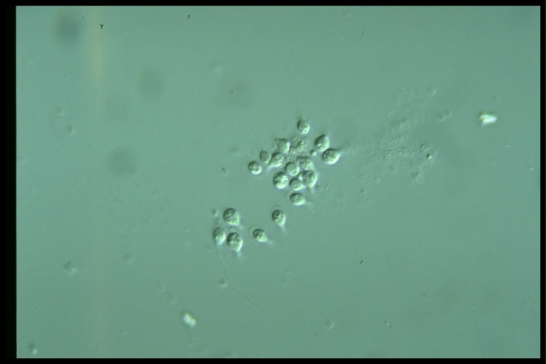 protist image