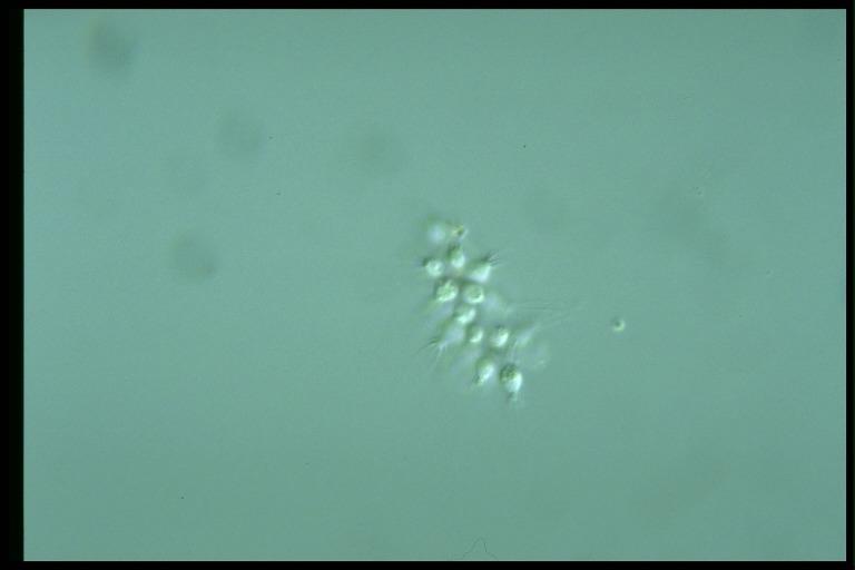 protist image