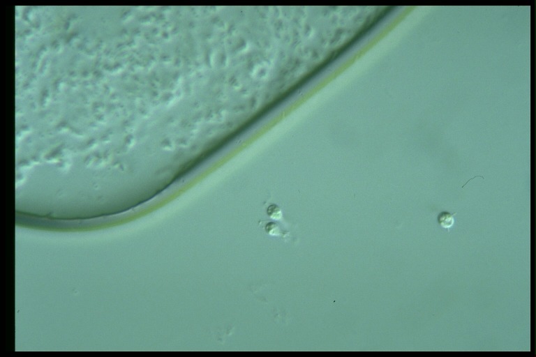 protist image