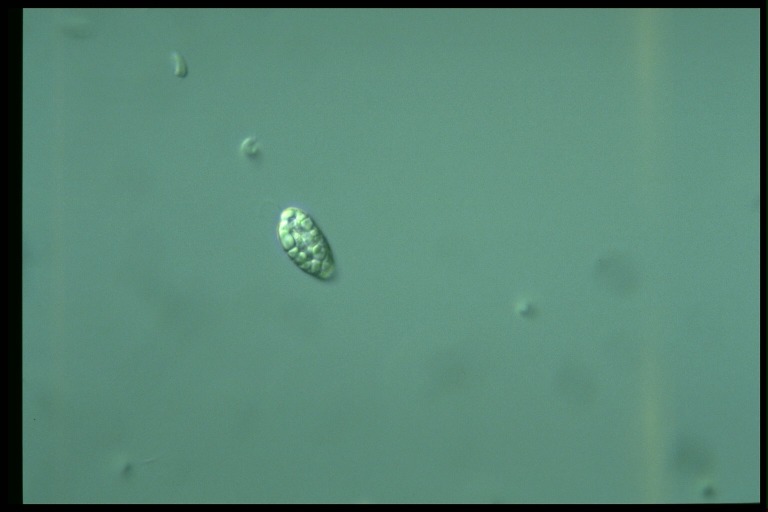 protist image