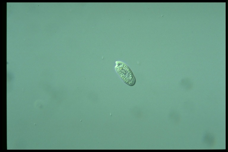 protist image