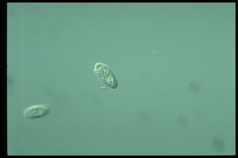 protist image