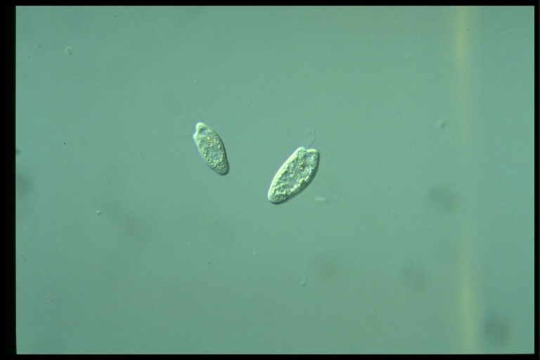 protist image