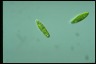 Euglena gracilis