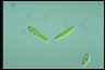 Euglena gracilis