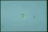 Oocystis