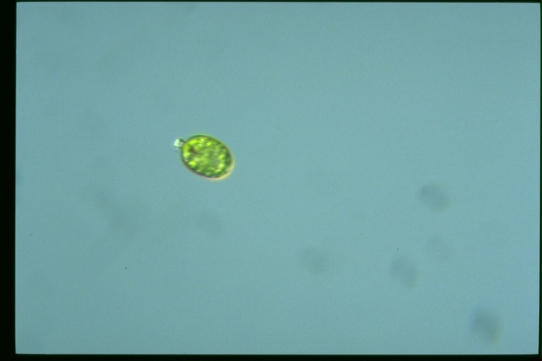 protist image