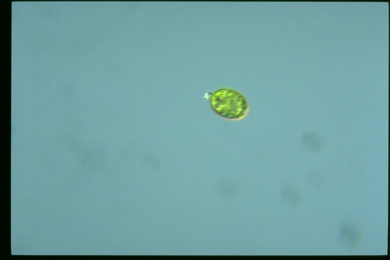 protist image