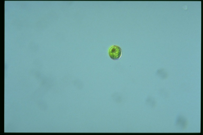 protist image