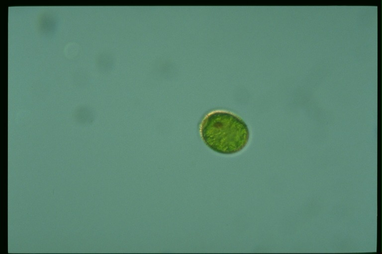 protist image