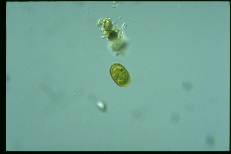 protist image