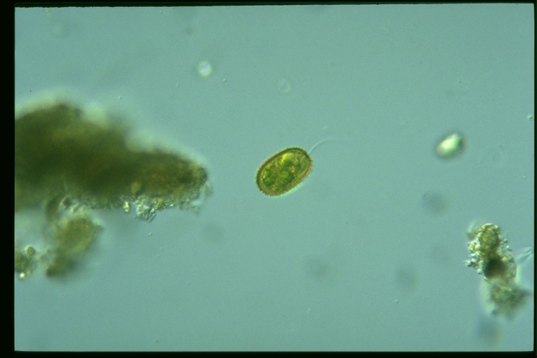 protist image