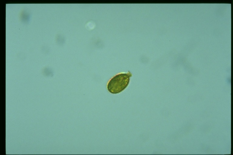 protist image