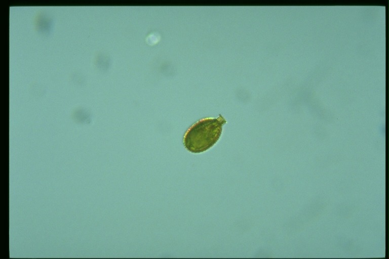 protist image