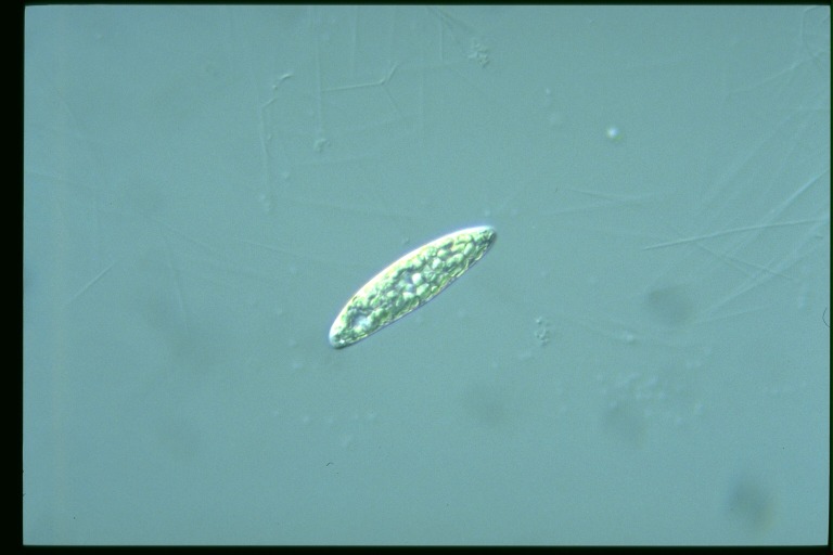 protist image