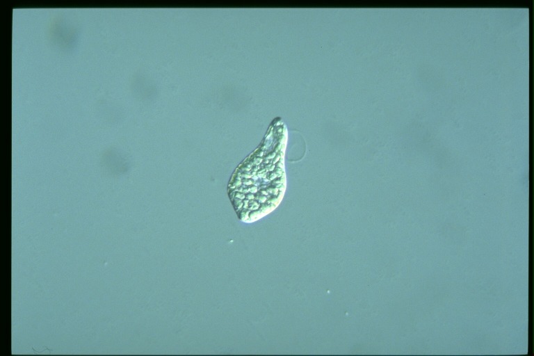 protist image