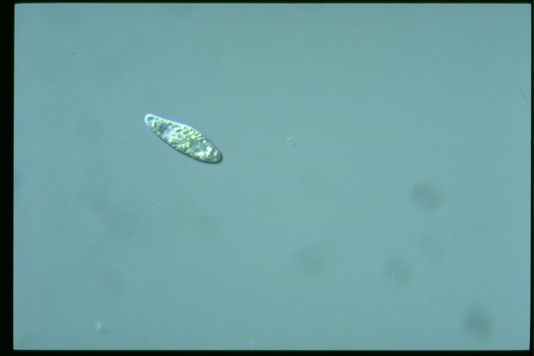 protist image