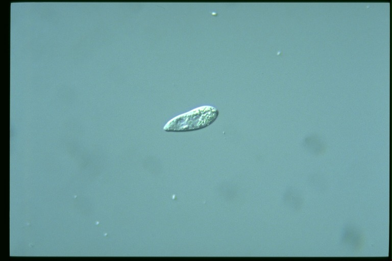 protist image