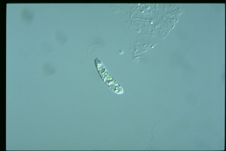 protist image