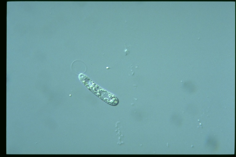 protist image