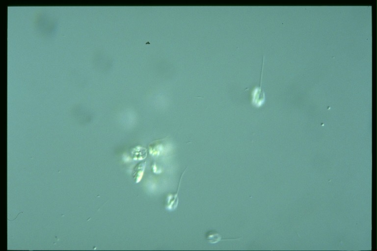 protist image