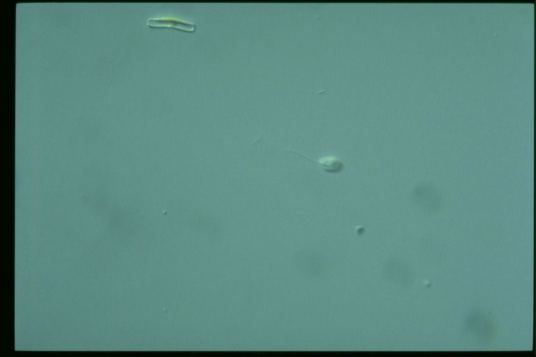 protist image